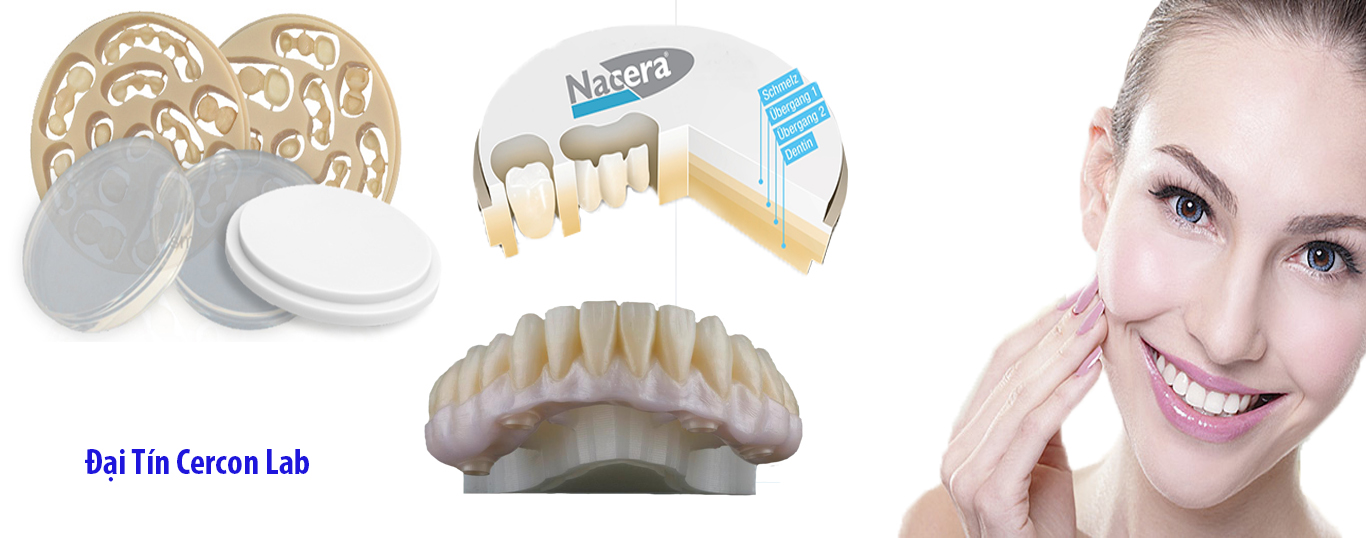 Nacera