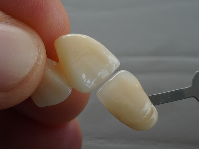 NACERA® PEARL NATURAL