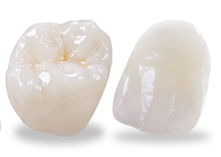 Răng sứ E-Max ZirCad